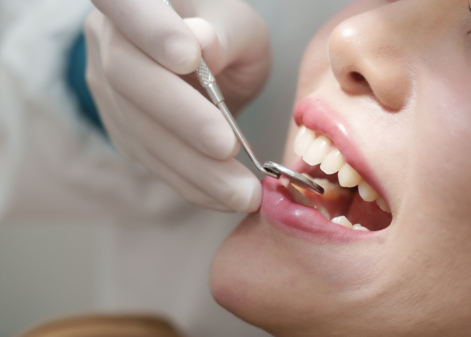 Candidates for cosmetic recontouring typically have healthy teeth with minor imperfections.
