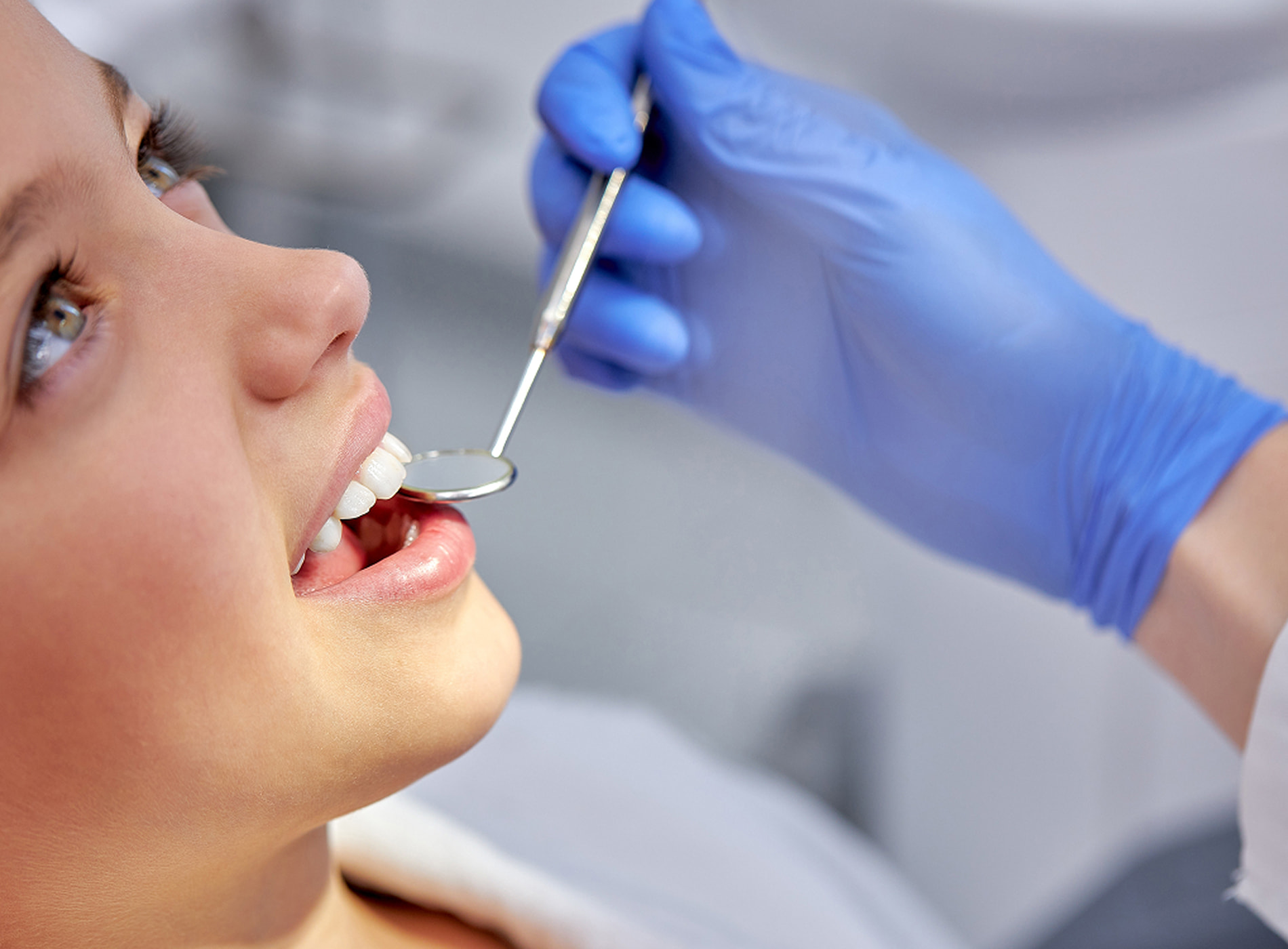 Dental sealants create an invisible barrier on molars to prevent cavities and protect teeth.