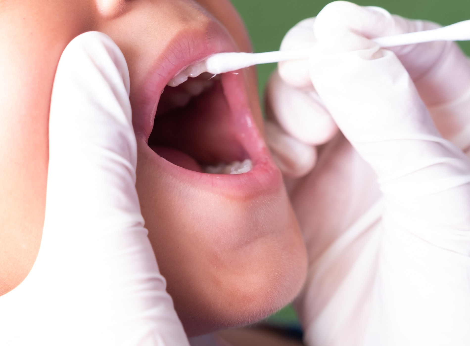 Fluoride protects teeth and prevents cavities naturally.