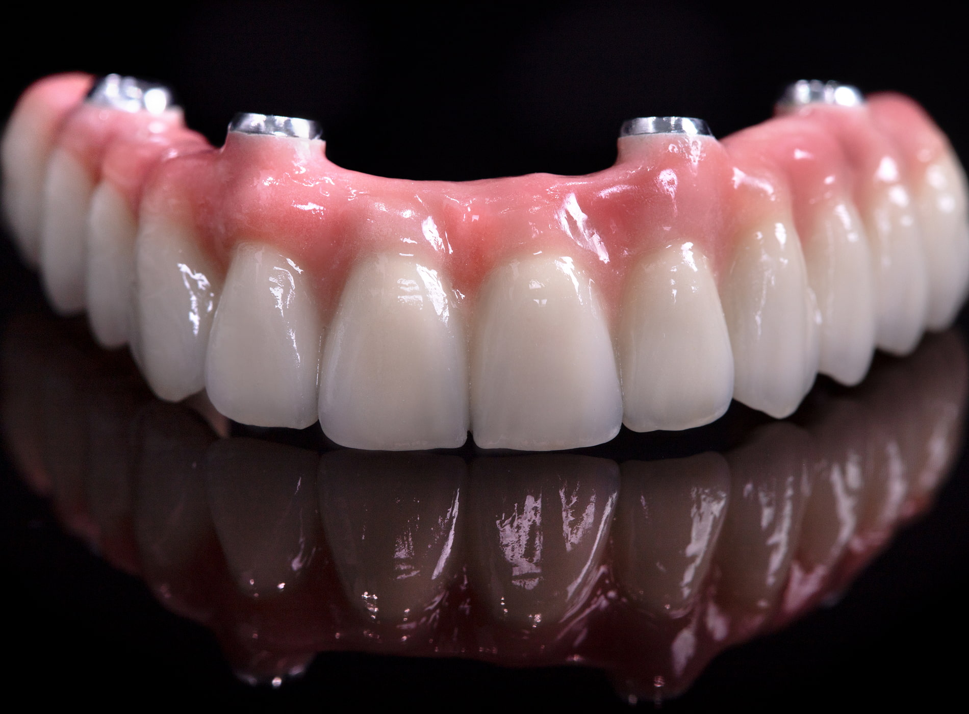 Proper care and maintenance of implant dentures
