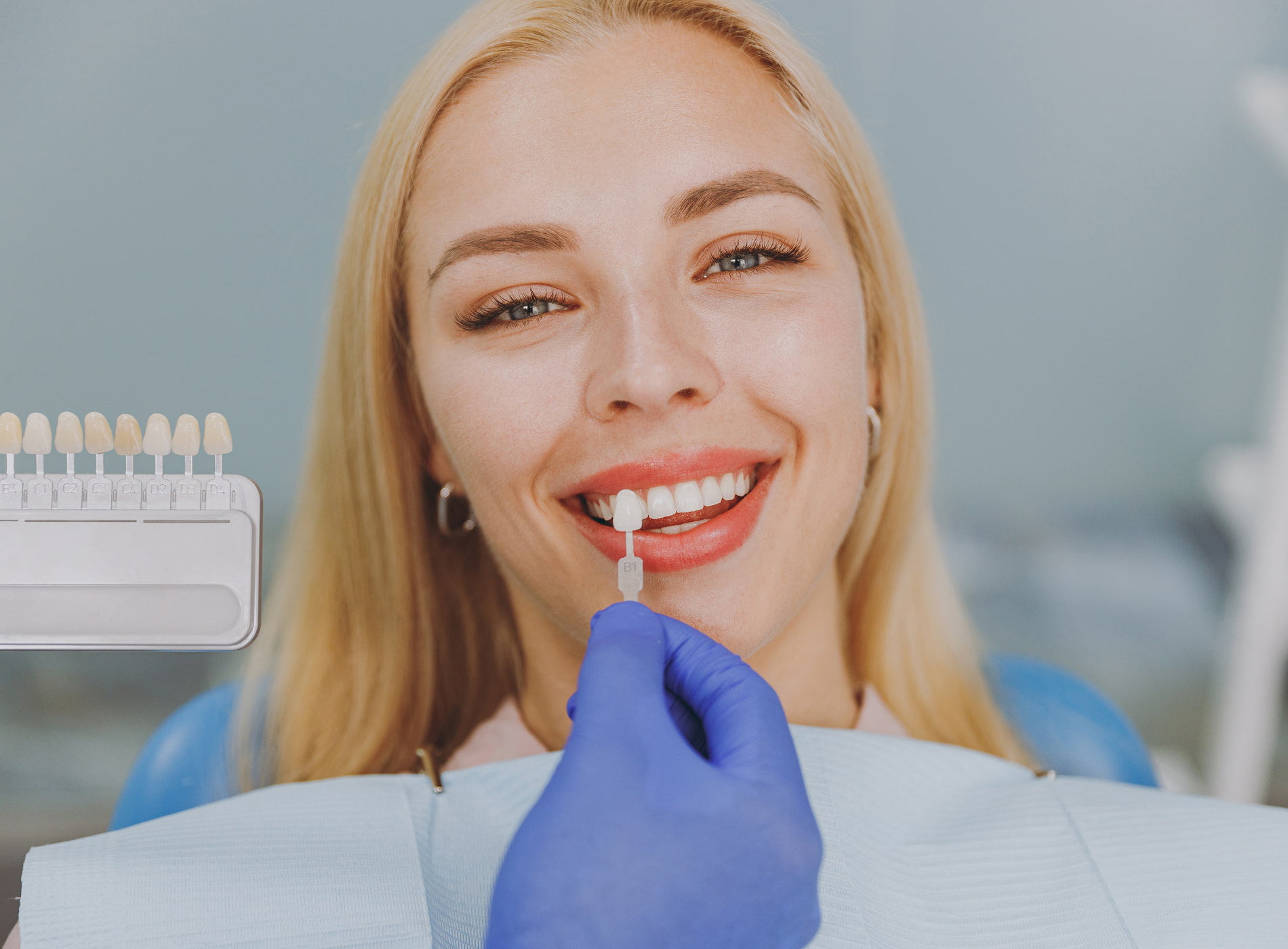 Porcelain veneers correct stains, chips, gaps, and minor misalignment for a flawless smile