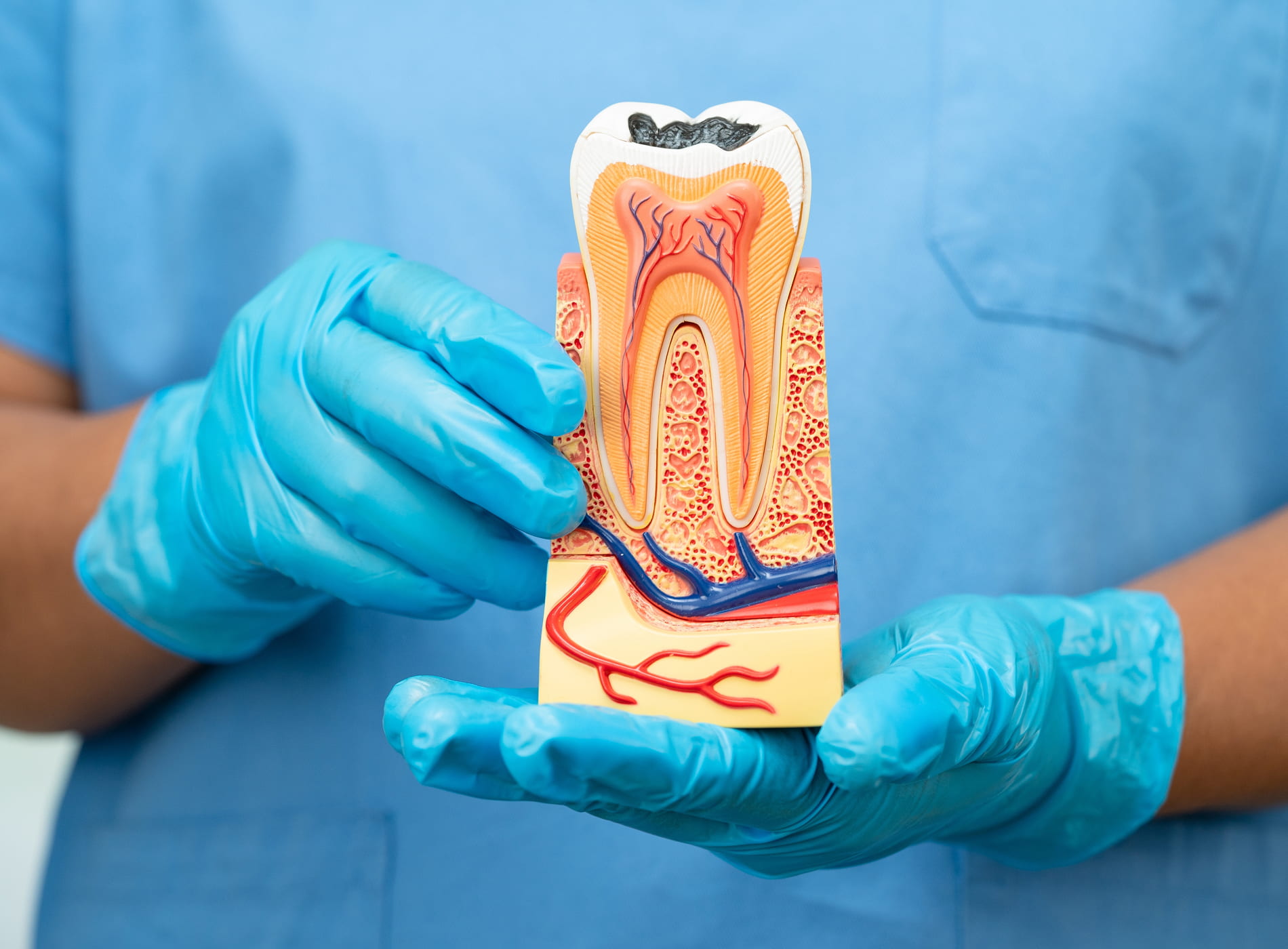 Gentle and comfortable root canal procedure at Dullat Cosmetic Dental & Implants