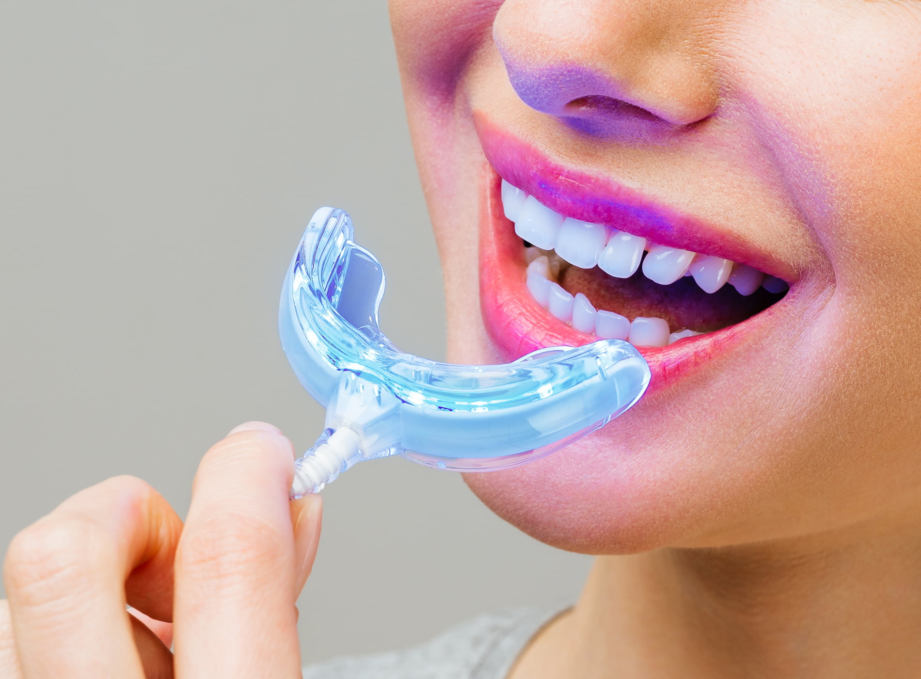 Professional teeth whitening vs. store-bought kits